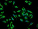 IMPDH2 Antibody in Immunocytochemistry (ICC/IF)