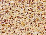 CD51 Antibody in Immunohistochemistry (Paraffin) (IHC (P))