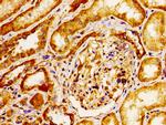 CD51 Antibody in Immunohistochemistry (Paraffin) (IHC (P))