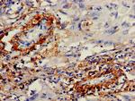 IMPDH2 Antibody in Immunohistochemistry (Paraffin) (IHC (P))