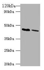 Kir1.1 (KCNJ1) Antibody in Western Blot (WB)