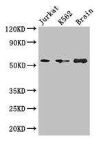 KIAA0513 Antibody in Western Blot (WB)