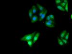 KIDINS220 Antibody in Immunocytochemistry (ICC/IF)