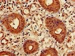 KIDINS220 Antibody in Immunohistochemistry (Paraffin) (IHC (P))