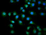 KIF3C Antibody in Immunocytochemistry (ICC/IF)