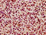 KIF3C Antibody in Immunohistochemistry (Paraffin) (IHC (P))