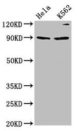 KIF3C Antibody in Western Blot (WB)