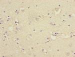 KLC1 Antibody in Immunohistochemistry (Paraffin) (IHC (P))