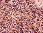 NKG2D Antibody in Immunohistochemistry (Paraffin) (IHC (P))