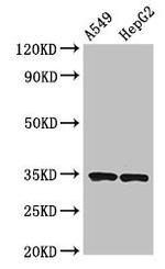 NKG2D Antibody in Western Blot (WB)