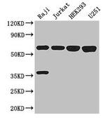 KPNA2 Antibody in Western Blot (WB)