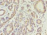 Cytokeratin 10 Antibody in Immunohistochemistry (Paraffin) (IHC (P))