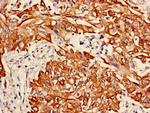 Cytokeratin 6A Antibody in Immunohistochemistry (Paraffin) (IHC (P))