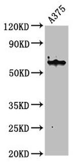 Cytokeratin 6A Antibody in Western Blot (WB)