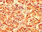 LETM1 Antibody in Immunohistochemistry (Paraffin) (IHC (P))