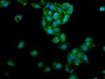 LIPA Antibody in Immunocytochemistry (ICC/IF)