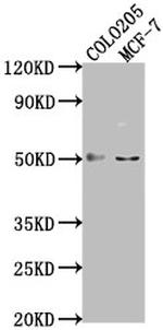 LRAT Antibody in Western Blot (WB)