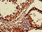 EMP Antibody in Immunohistochemistry (Paraffin) (IHC (P))