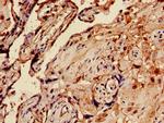 MAGEA10 Antibody in Immunohistochemistry (Paraffin) (IHC (P))