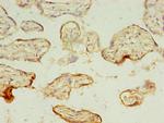 MAGEA10 Antibody in Immunohistochemistry (Paraffin) (IHC (P))