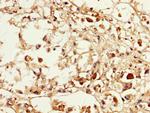 MAGEA3 Antibody in Immunohistochemistry (Paraffin) (IHC (P))