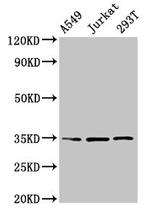 MAGEA3 Antibody in Western Blot (WB)