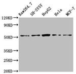 MATN3 Antibody in Western Blot (WB)