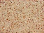 MBD3 Antibody in Immunohistochemistry (Paraffin) (IHC (P))