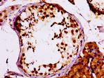 MCM4 Antibody in Immunohistochemistry (Paraffin) (IHC (P))