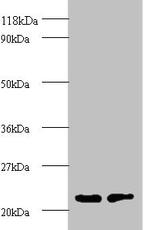 PSMB2 Antibody in Western Blot (WB)