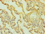 Mesothelin Antibody in Immunohistochemistry (Paraffin) (IHC (P))