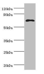 Mesothelin Antibody in Western Blot (WB)