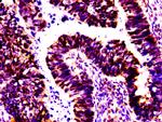 MSX2 Antibody in Immunohistochemistry (Paraffin) (IHC (P))