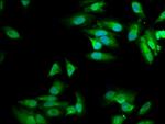 MVD Antibody in Immunocytochemistry (ICC/IF)