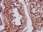 MVD Antibody in Immunohistochemistry (Paraffin) (IHC (P))