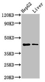 MVD Antibody in Western Blot (WB)