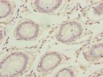 RPA2 Antibody in Immunohistochemistry (Paraffin) (IHC (P))