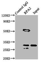 RPA2 Antibody in Western Blot (WB)