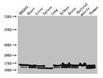 NDUFB6 Antibody in Western Blot (WB)