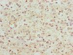 NDUFS1 Antibody in Immunohistochemistry (Paraffin) (IHC (P))