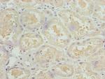 NDUFS1 Antibody in Immunohistochemistry (Paraffin) (IHC (P))