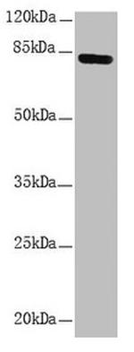 NDUFS1 Antibody in Western Blot (WB)