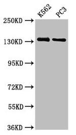 Nardilysin Antibody in Western Blot (WB)