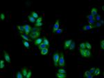 TrkA Antibody in Immunocytochemistry (ICC/IF)