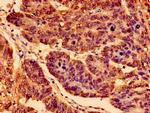 TrkA Antibody in Immunohistochemistry (Paraffin) (IHC (P))