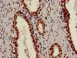 Ku70 Antibody in Immunohistochemistry (Paraffin) (IHC (P))