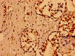 NuMA Antibody in Immunohistochemistry (Paraffin) (IHC (P))