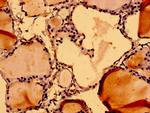 NuMA Antibody in Immunohistochemistry (Paraffin) (IHC (P))