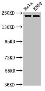 NuMA Antibody in Western Blot (WB)