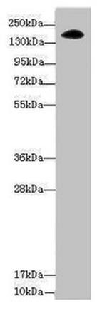 NUP155 Antibody in Western Blot (WB)